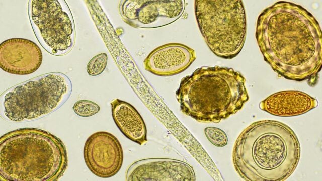 What Are Parasites?