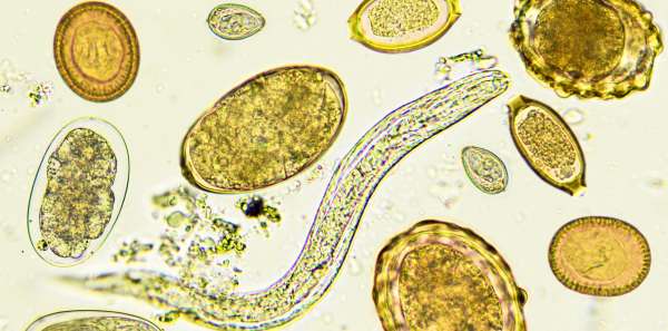 Why Everyone Needs a Parasite Cleanse